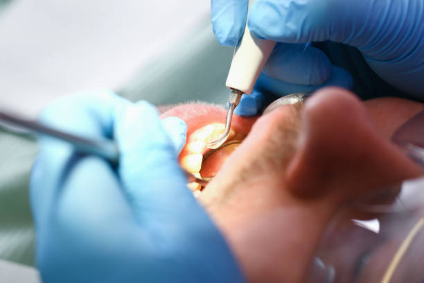 Best Emergency Tooth Extraction  in Center Point, IA