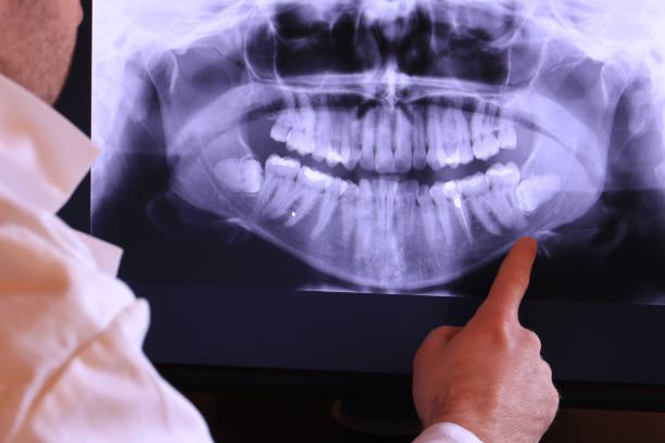 Best Chipped Tooth Repair Near Me  in Center Point, IA